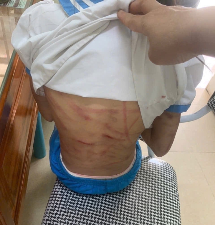 Bắt giữ bố dượng nghi bạo hành bé gái lớp 5 ở Hà Tĩnh- Ảnh 2.