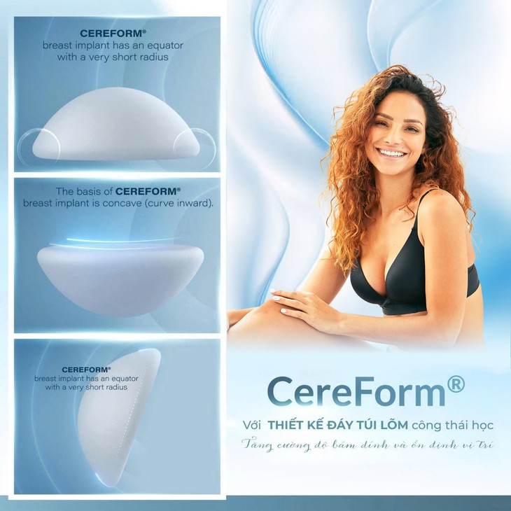 Túi ngực Cereform đạt chuẩn châu Âu chính thức phân phối tại Việt Nam- Ảnh 3. Túi ngực Cereform đạt chuẩn châu Âu chính thức phân phối tại Việt Nam- Ảnh 3.