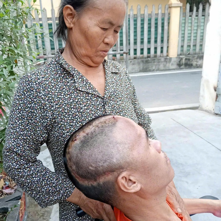 Xót xa hoàn cảnh người đàn ông đơn thân chăm mẹ già và con nhỏ gặp tai nạn nghiêm trọng cần tiền ghép sọ não- Ảnh 1.