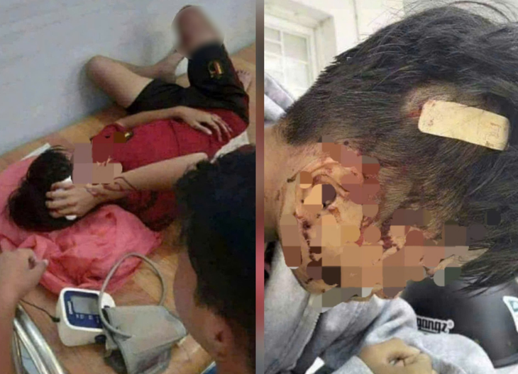 Vết thương dai dẳng từ bạo lực học đường và bài toán an toàn chưa lời giải- Ảnh 1.