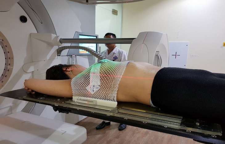 Mặt trái của xạ trị và hóa trị: Hiểm họa ung thư thứ phát- Ảnh 1.