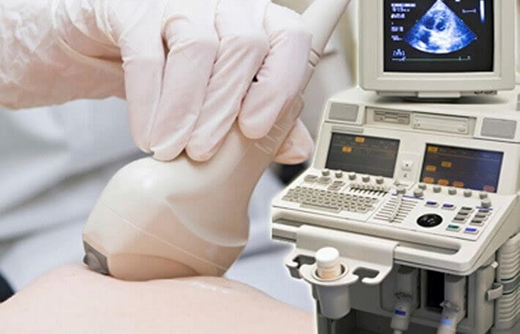 500 phụ nữ được tầm soát ung thư vú miễn phí tại BV Ung bướu TPHCM- Ảnh 1.