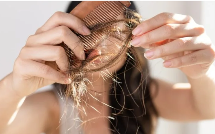 5 nguyên nhân gây rụng tóc hàng đầu và cách chữa tại nhà