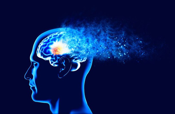 Nguy cơ sa sút trí tuệ và Alzheimer sớm ở người nhiễm HIV- Ảnh 1.