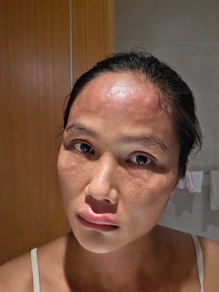 Động thái gây chú ý của H'Hen Niê sau chia sẻ về bệnh nổi mề đay sau sinh- Ảnh 2. Động thái gây chú ý của H'Hen Niê sau chia sẻ về bệnh nổi mề đay sau sinh- Ảnh 2.