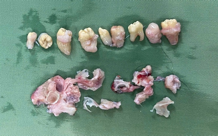 Hy hữu: Bác sĩ phẫu thuật 