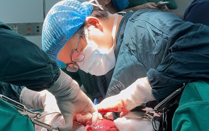 Cứu bé trai 13 tuổi bị lồng ruột nhờ loại bỏ polyp đại tràng lớn- Ảnh 5.