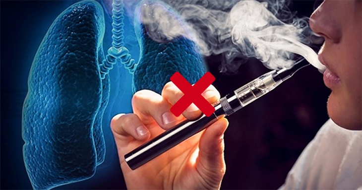 Bác sĩ nhắn nhủ giới trẻ không để bị mê hoặc bởi thuốc lá điện tử- Ảnh 1.