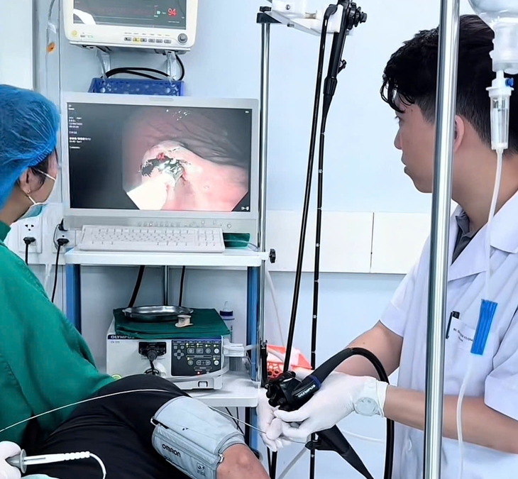 Đi khám vì ho, người đàn ông phát hiện u mô đệm dạ dày nguy hiểm- Ảnh 1.