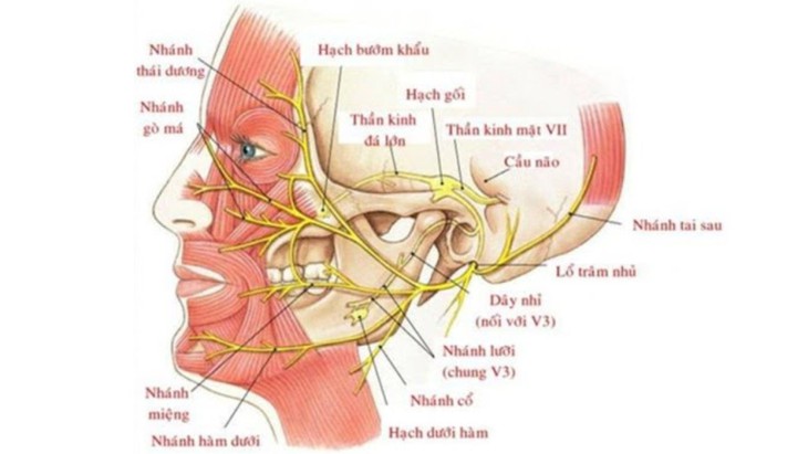 Loại bỏ khối u chung sống 10 năm gây liệt mặt- Ảnh 2.