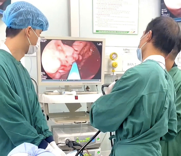 Nghĩ đau bụng bình thường, người đàn ông vào viện đã vỡ tĩnh mạch, máu phun thành tia trong dạ dày- Ảnh 3.