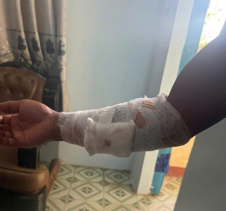 Truy tìm con cá sấu cắn nam thanh niên ở Khánh Hòa- Ảnh 1.