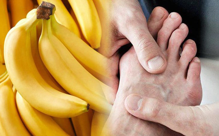 5 loại trái cây hỗ trợ kiểm soát nồng độ axit uric cao