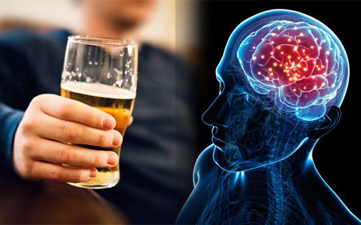 Có nên cho người say rượu ăn uống không?- Ảnh 4.