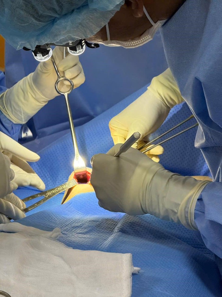 Tháo túi ngực và thay túi ngực: Phương pháp gây mê, kỹ thuật phẫu tích, hồi phục- Ảnh 3. Tháo túi ngực và thay túi ngực: Phương pháp gây mê, kỹ thuật phẫu tích, hồi phục- Ảnh 3.