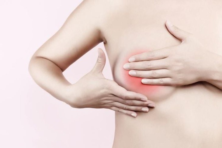 Cách kiểm tra phát hiện ung thư vú giai đoạn sớm- Ảnh 3.