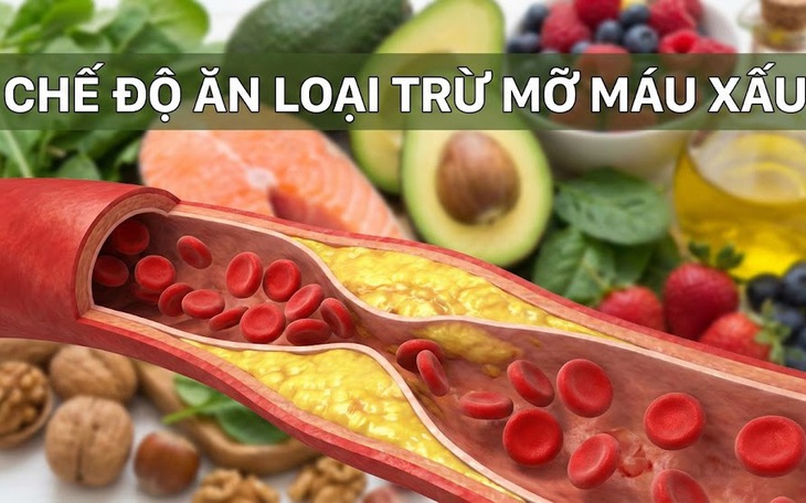Chế độ ăn loại bỏ ‘mỡ máu xấu’ bảo vệ thành mạch, ngừa đột quỵ