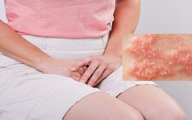 Cụ bà làm vườn nguy kịch vì vết đốt ở nách- Ảnh 3.