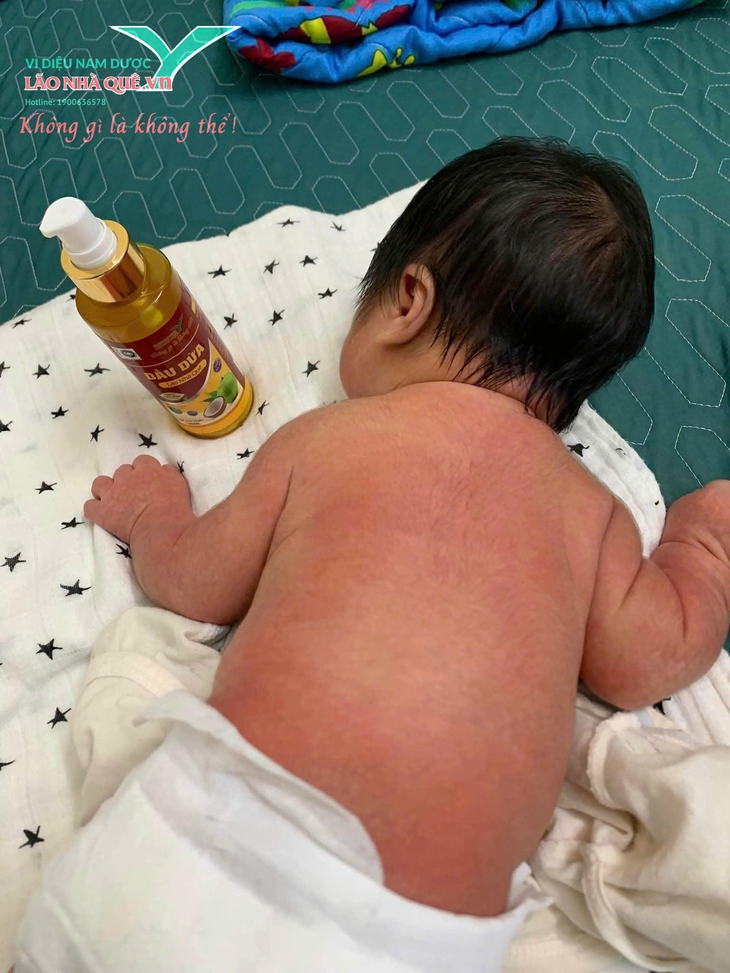 Giải pháp tự nhiên cho da khô nứt nẻ chai sần chỉ từ dầu dừa và nước muối ấm- Ảnh 2. Giải pháp tự nhiên cho da khô nứt nẻ chai sần chỉ từ dầu dừa và nước muối ấm- Ảnh 2.