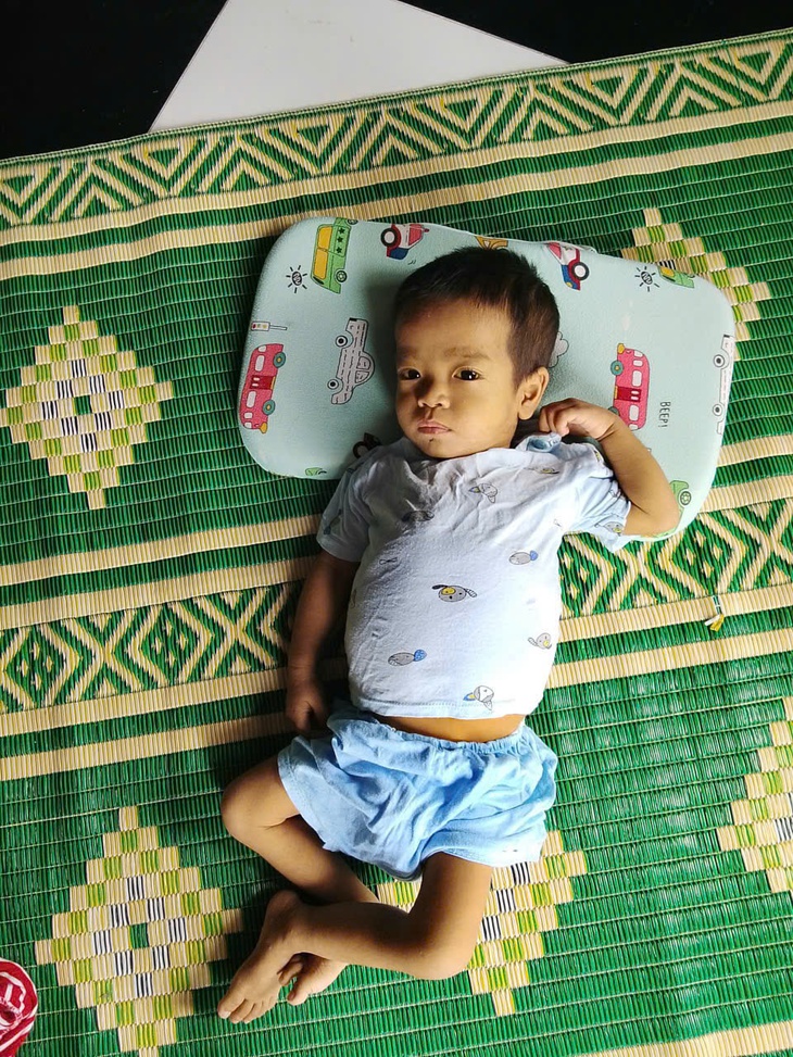 Xót xa hoàn cảnh bé trai bị teo mật bẩm sinh, mẹ sẵn sàng hiến gan cứu con nhưng không đủ kinh phí điều trị- Ảnh 1.