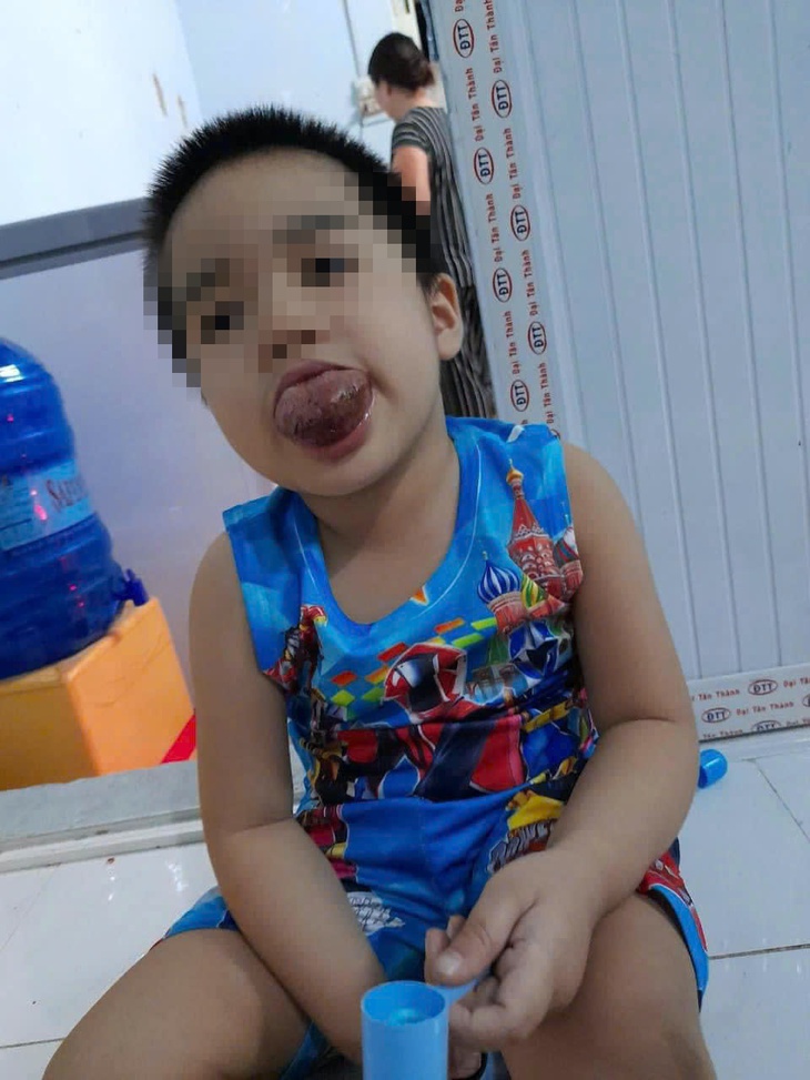 Phẫu thuật thu nhỏ chiếc lưỡi khổng lồ giúp cậu bé 9 tuổi tìm lại nụ cười- Ảnh 1.