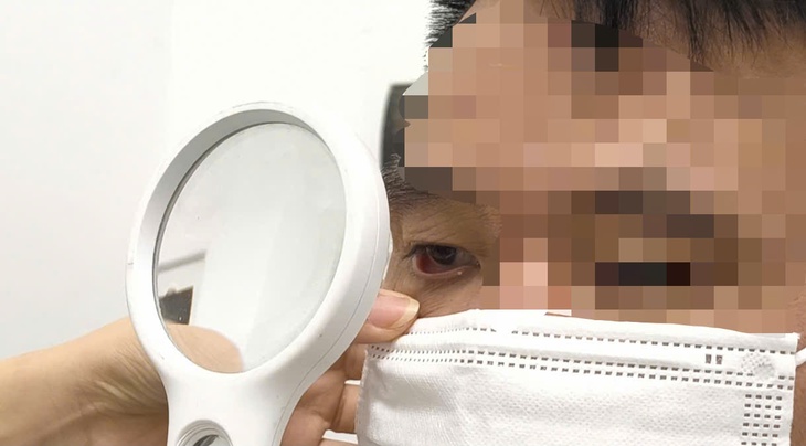 Người đàn ông bị rận mu hành hạ suốt một năm- Ảnh 2.