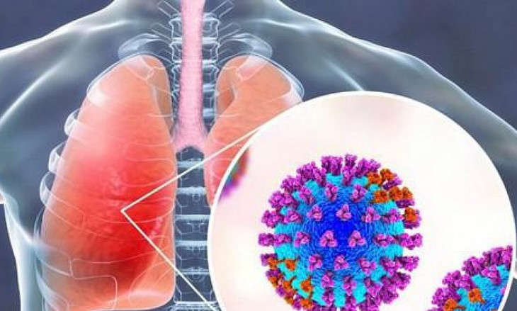 Bệnh do virus hợp bào hô hấp (RSV) có cần dùng thuốc?- Ảnh 1.