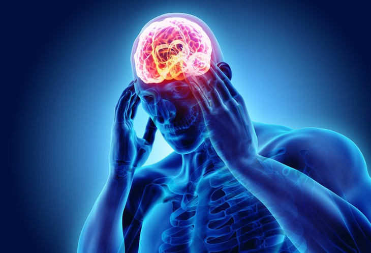 Lý do khiến một số thực phẩm kích hoạt cơn đau đầu- Ảnh 1.