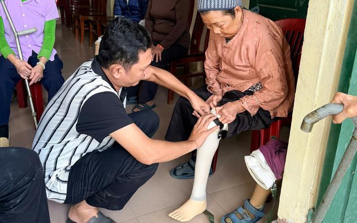 Bàn chân không còn vẫn đau dữ dội: Đó có phải đau chi ma? - Ảnh 3.