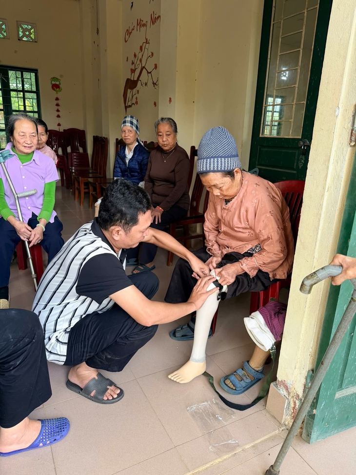 66 bệnh nhân phong được lắp chân giả, trao bước đi vững vàng- Ảnh 4. 66 bệnh nhân phong được lắp chân giả, trao bước đi vững vàng- Ảnh 4.