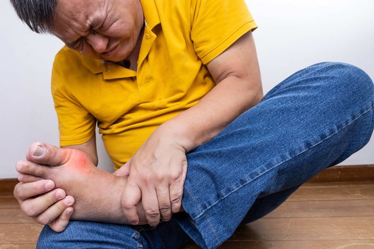 Cảnh giác với 2 loại đồ uống có thể làm bùng phát cơn gout cấp trong kỳ nghỉ lễ- Ảnh 1.