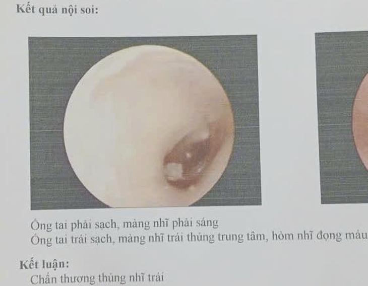 Vụ nữ sinh bị đánh hội đồng ở Đà Nẵng: Gia đình mời chuyên viên tâm lý hỗ trợ- Ảnh 1.