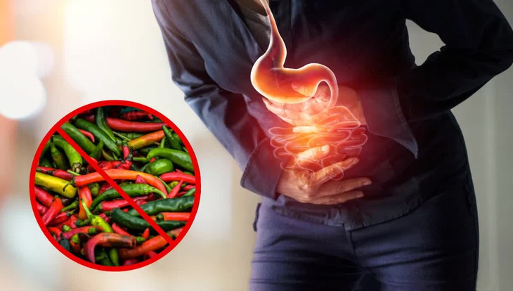 Ăn nhiều ớt gây hại gì?- Ảnh 1. Ăn nhiều ớt gây hại gì?- Ảnh 1.