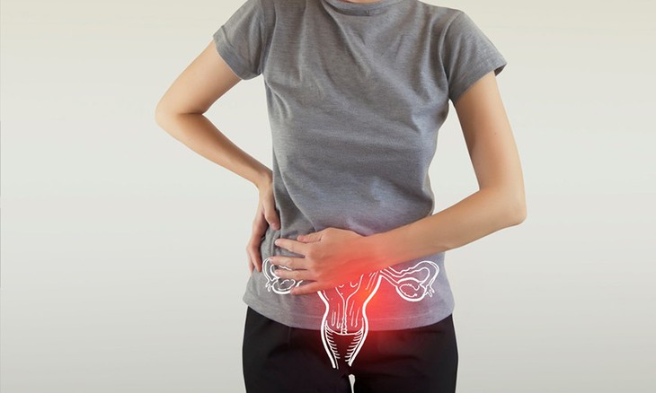 5 loại thuốc cần thận trọng dùng trong thời kỳ kinh nguyệt- Ảnh 1. 5 loại thuốc cần thận trọng dùng trong thời kỳ kinh nguyệt- Ảnh 1.
