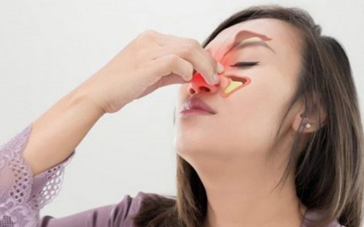 Viêm xoang dị ứng thời tiết chữa thế nào hiệu quả?