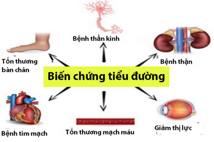 Cần ổn định đường huyết kết hợp các biện pháp điều trị (thuốc, chế độ ăn uống và sinh hoạt, kiểm soát cân nặng) một cách bài bản và hiệu quả. Ảnh minh họa Cần ổn định đường huyết kết hợp các biện pháp điều trị (thuốc, chế độ ăn uống và sinh hoạt, kiểm soát cân nặng) một cách bài bản và hiệu quả. Ảnh minh họa