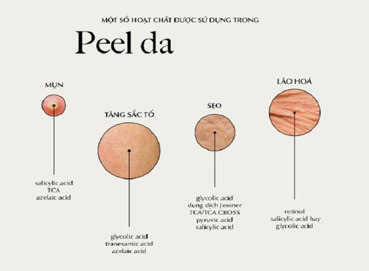 Cách làm đẹp bằng peel da- Ảnh 1. Cách làm đẹp bằng peel da- Ảnh 1.