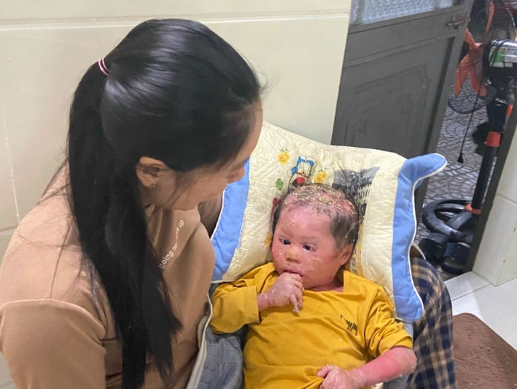 Xót xa bé trai 2 tuổi da toàn thân bong tróc vì bệnh quái ác, mẹ chỉ mong có đủ tiền mua băng gạc cho con- Ảnh 2.