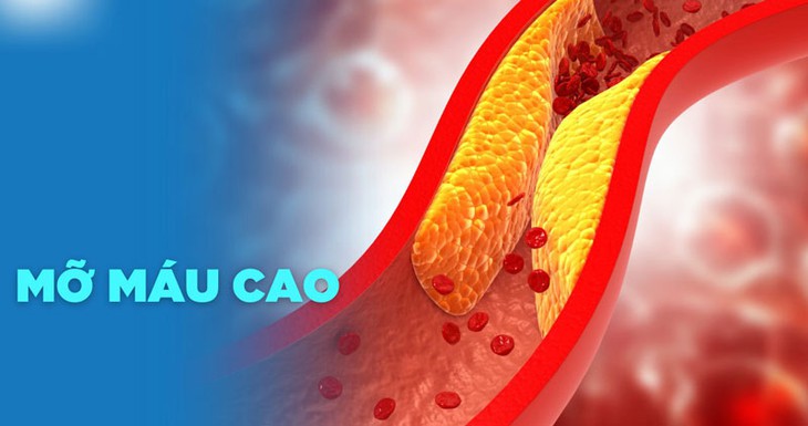 Tăng cholesterol máu không chỉ gây ra xơ vữa mạch, nhồi máu cơ tim, tai biến mạch máu não… có thể dẫn đến tử vong mà còn ảnh hưởng đến đời sống tình dục ở cả nam và nữ.