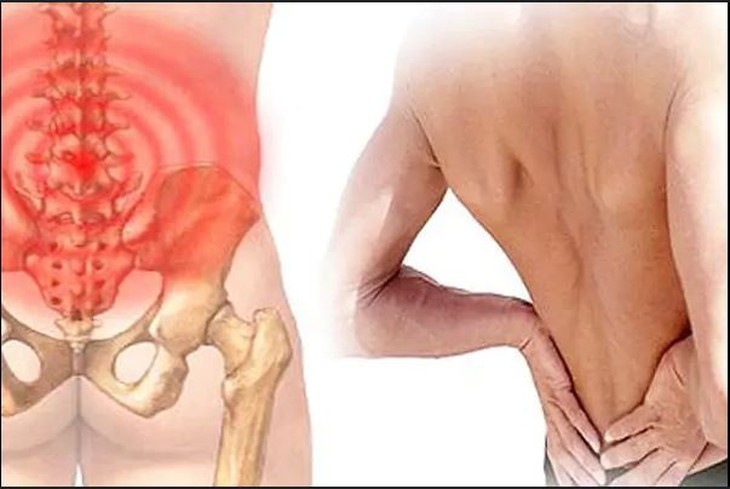 Chèn ép dây thần kinh thẹn: Nguyên nhân, biểu hiện, cách điều trị và phòng bệnh- Ảnh 1. Chèn ép dây thần kinh thẹn: Nguyên nhân, biểu hiện, cách điều trị và phòng bệnh- Ảnh 1.
