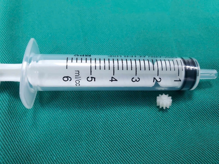 Liên tục tiếp nhận nhiều bệnh nhi hóc dị vật- Ảnh 2.