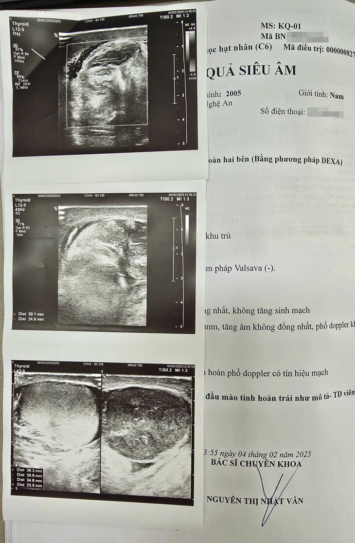 Đau vùng kín sau khi tắm, nam thanh niên phải cắt bỏ một bên tinh hoàn- Ảnh 1. Đau vùng kín sau khi tắm, nam thanh niên phải cắt bỏ một bên tinh hoàn- Ảnh 1.