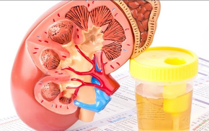 Đạm niệu: Nguyên nhân, biểu hiện, cách điều trị và phòng bệnh
