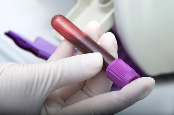 Tùy thuộc vào kế hoạch điều trị người bệnh có hội chứng antiphospholipid sẽ có các kế hoạch để bảo vệ sức khỏe của mình.