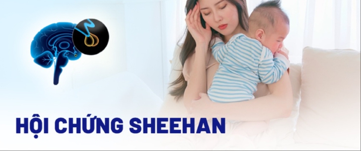 Hội chứng Sheehan hay suy tuyến yên sau sinh là một rối loạn hiếm gặp, xảy ra do thiếu máu nuôi dưỡng cục bộ trong hoặc sau sinh con, dẫn đến hoại tử tuyến yên