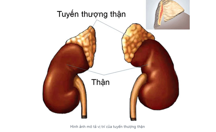 Suy tuyến thượng thận: Hiểu đúng để điều trị hiệu quả- Ảnh 2.