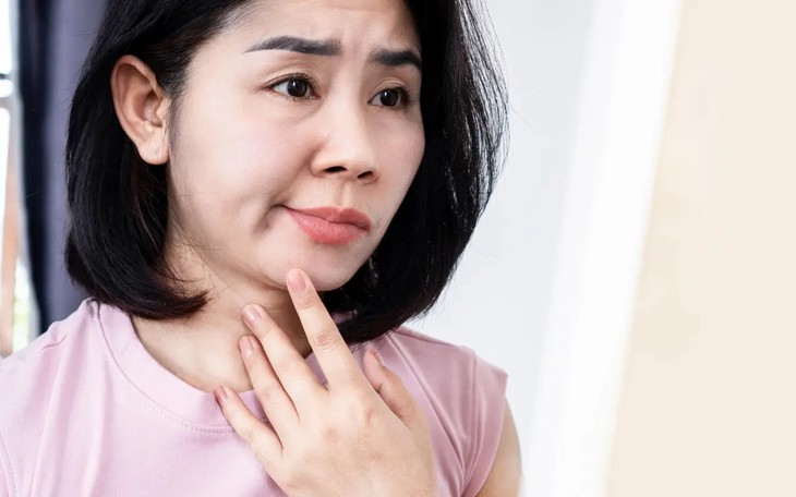 Chế độ dinh dưỡng chăm sóc người bị liệt mặt