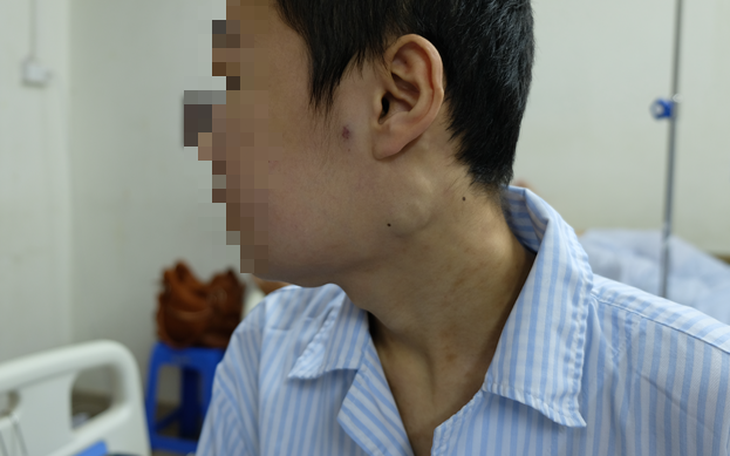 Leukemia cấp: Nguyên nhân, triệu chứng, phòng ngừa và điều trị