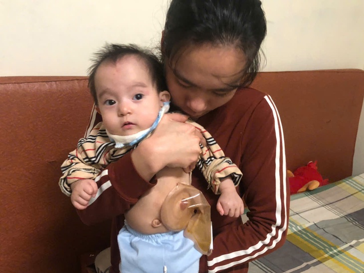 Xót thương bé gái 1 tuổi cần tiền phẫu thuật hậu môn nhân tạo- Ảnh 2. Xót thương bé gái 1 tuổi cần tiền phẫu thuật hậu môn nhân tạo- Ảnh 2.