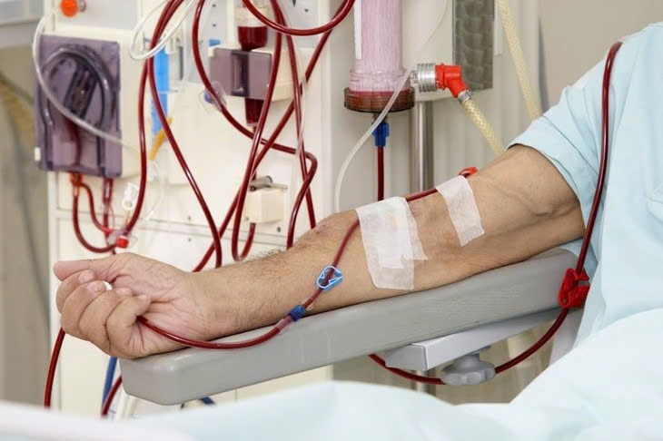 Chưa có đủ bằng chứng y khoa về lọc máu, huyết tương phòng bệnh mỡ máu, đột quỵ- Ảnh 1. Chưa có đủ bằng chứng y khoa về lọc máu, huyết tương phòng bệnh mỡ máu, đột quỵ- Ảnh 1.